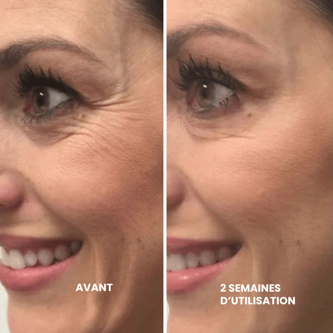 SOIN ANTI-ÂGE AU RÉTINOL SEREYA™