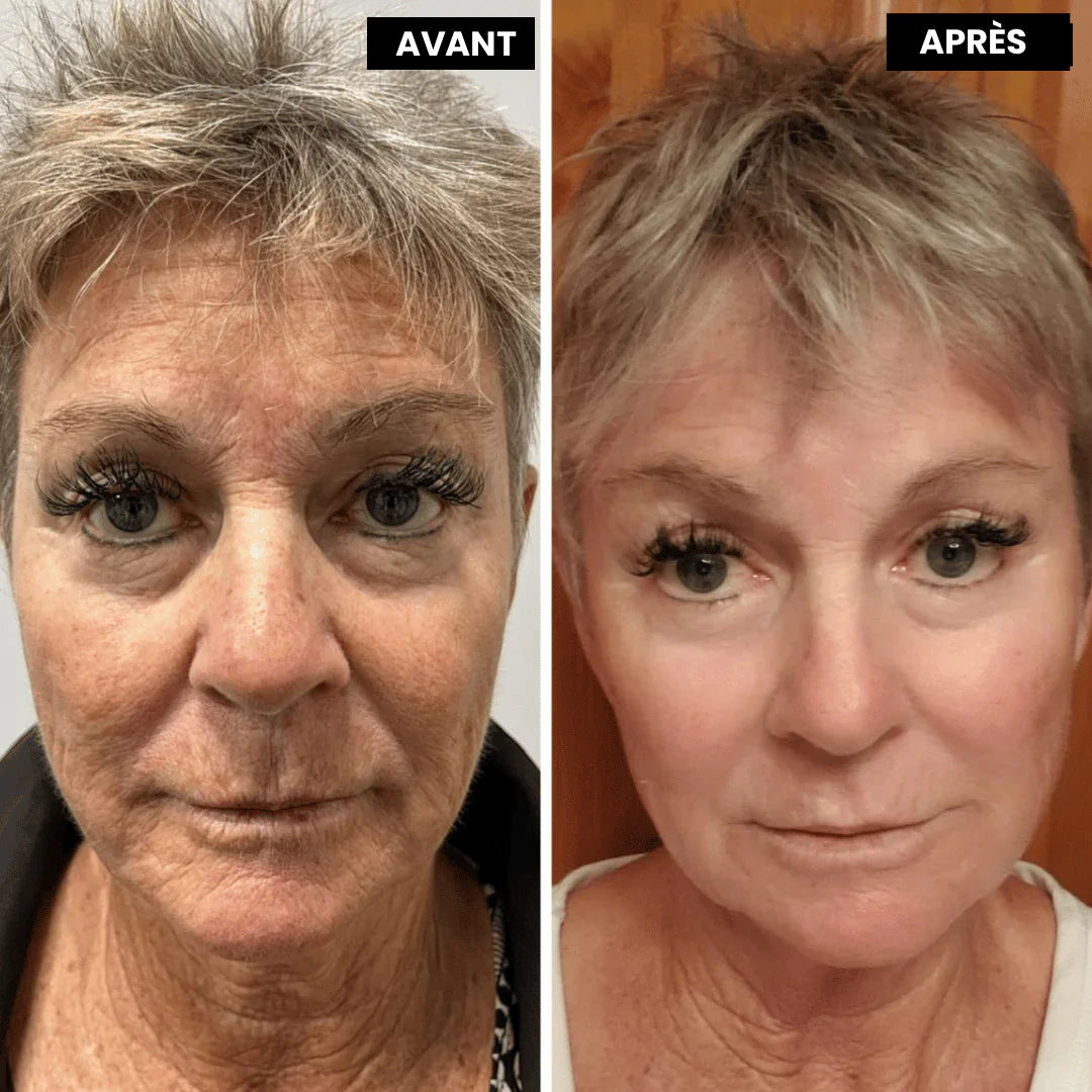 SOIN ANTI-ÂGE AU RÉTINOL SEREYA™
