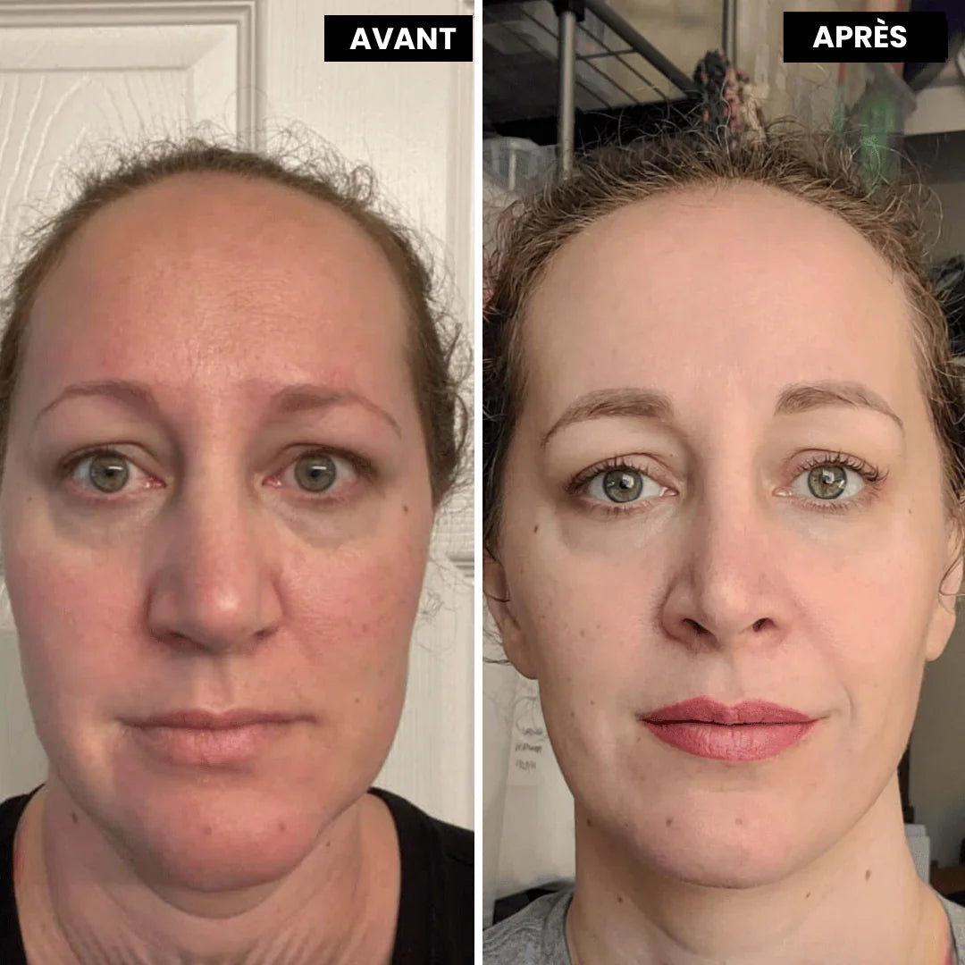 SOIN ANTI-ÂGE AU RÉTINOL SEREYA™