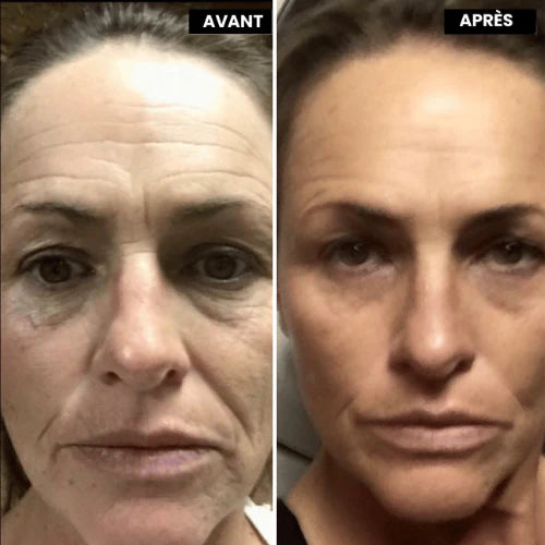 SOIN ANTI-ÂGE AU RÉTINOL SEREYA™